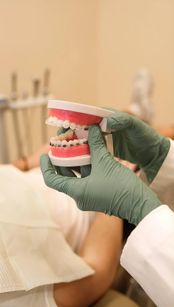 Dental Braces